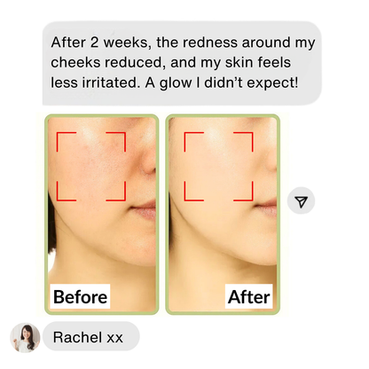 Holy Basil Bubble Deep Mask – Clearer Skin, Smaller Pores