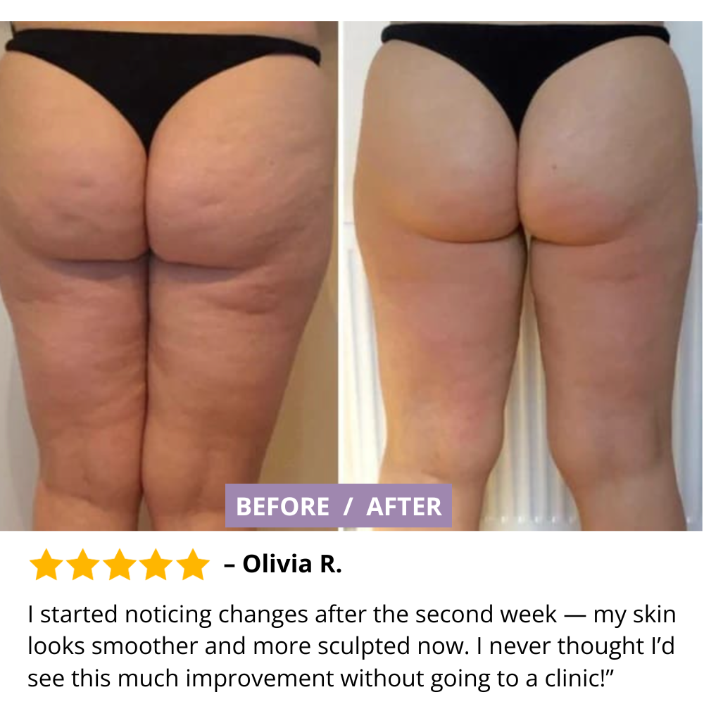 Vacuum Slimming Massager – Cellulite Reduction & Skin Firming