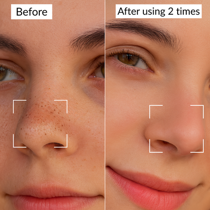 Clear Pores Nose Patches (24 pcs.) – Deep Clean & Smooth Skin