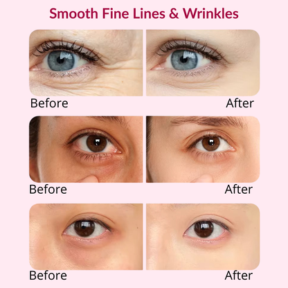 3D Eye Relax Massager – Soothe Fatigue, Brighten Dark Circles & Smooth Fine Lines