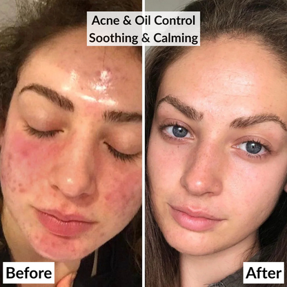 Hydrating Hyaluronic Acid Jelly Mask (650g / 23Fl Oz) – Spa Facial at Home