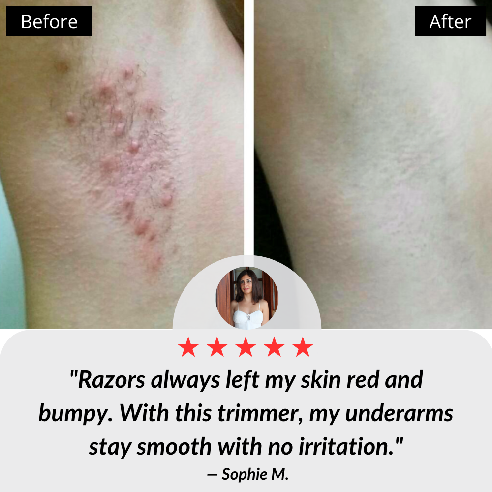 4-in-1 Rechargeable Electric Shaver