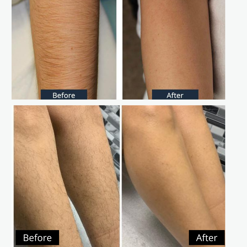 4-in-1 Rechargeable Electric Shaver