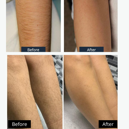 4-in-1 Rechargeable Electric Shaver