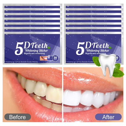 5D Teeth Whitening Strips – Professional Results at Home