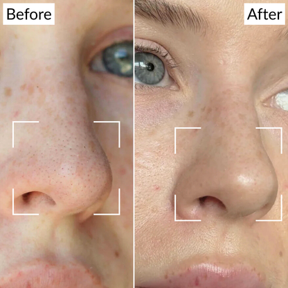 Clear Pores Nose Patches (24 pcs.) – Deep Clean & Smooth Skin