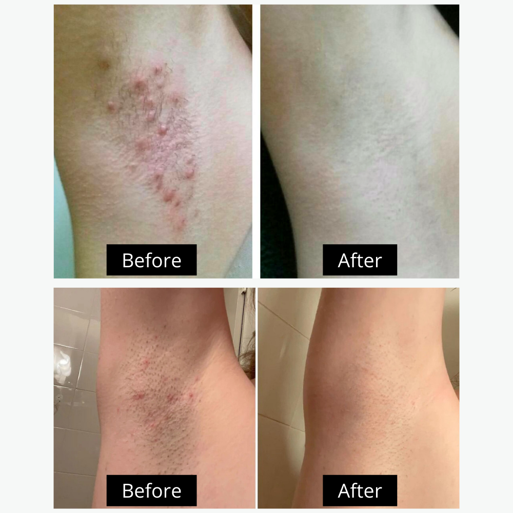 2-in-1 Dual Head Electric Shaver & Precision Trimmer