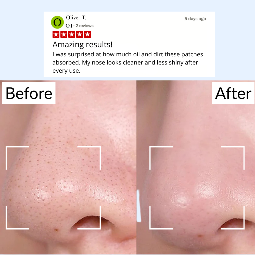 Clear Pores Nose Patches (24 pcs.) – Deep Clean & Smooth Skin