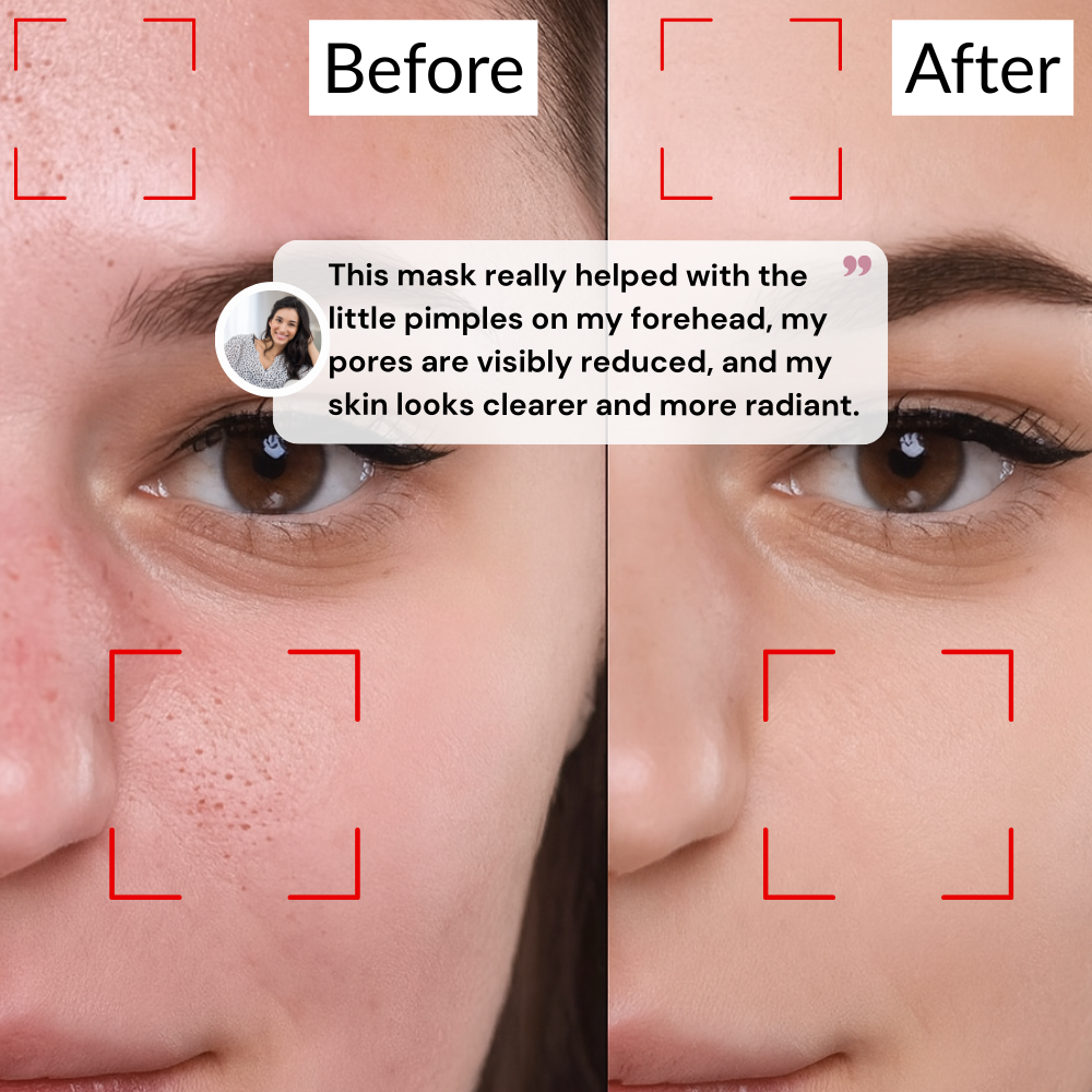 Holy Basil Bubble Deep Mask – Clearer Skin, Smaller Pores