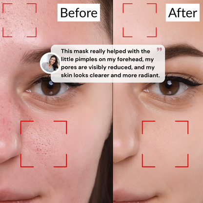 Holy Basil Bubble Deep Mask – Clearer Skin, Smaller Pores