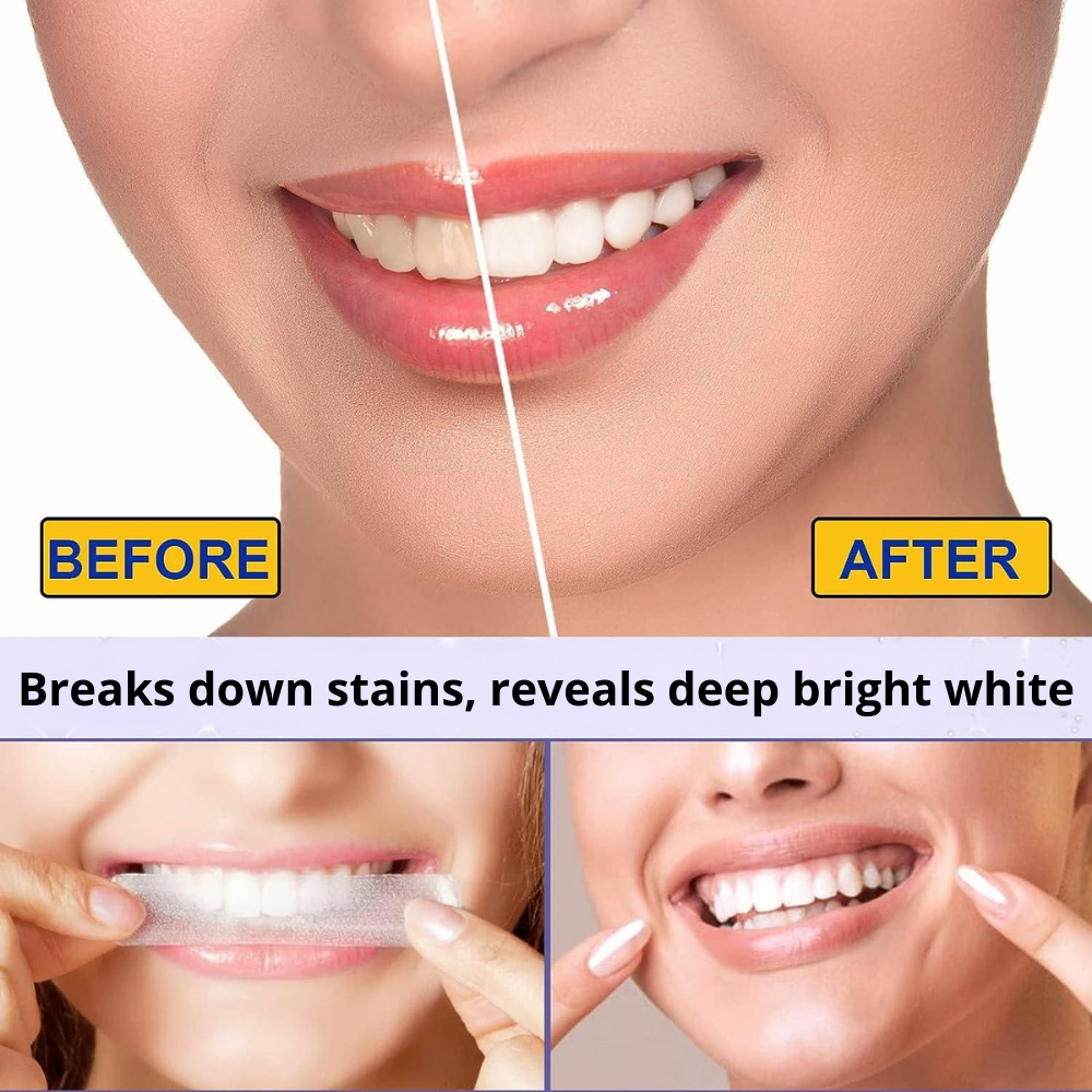 5D Teeth Whitening Strips – Professional Results at Home