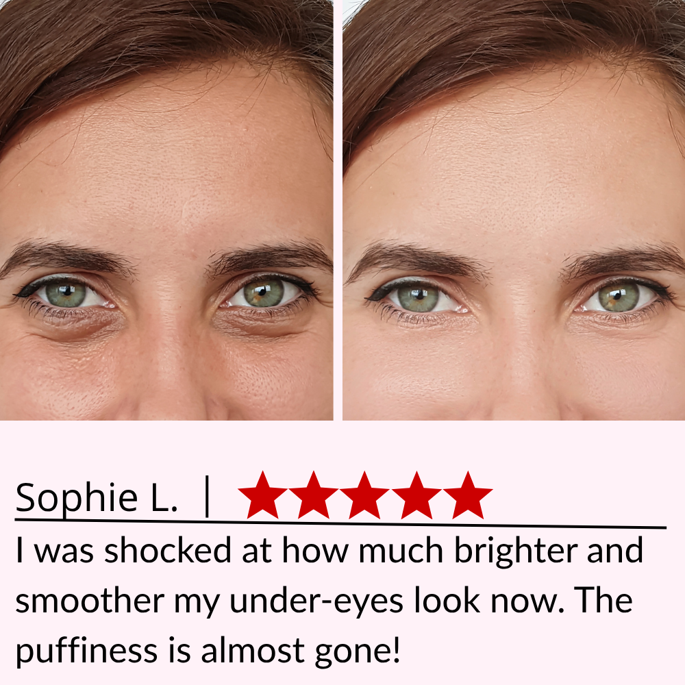 3D Eye Relax Massager – Soothe Fatigue, Brighten Dark Circles & Smooth Fine Lines