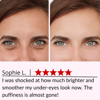 3D Eye Relax Massager – Soothe Fatigue, Brighten Dark Circles & Smooth Fine Lines