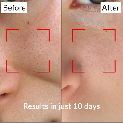 Holy Basil Bubble Deep Mask – Clearer Skin, Smaller Pores