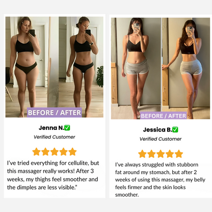 Vacuum Slimming Massager – Cellulite Reduction & Skin Firming