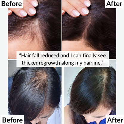 Pure Flow Shower – For Skin & Hair Wellness